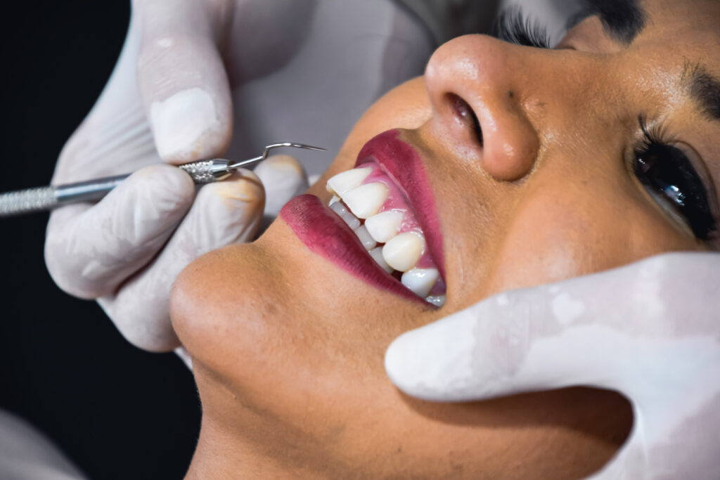 Odontología estética: una inversión en la salud oral, belleza y autoestima