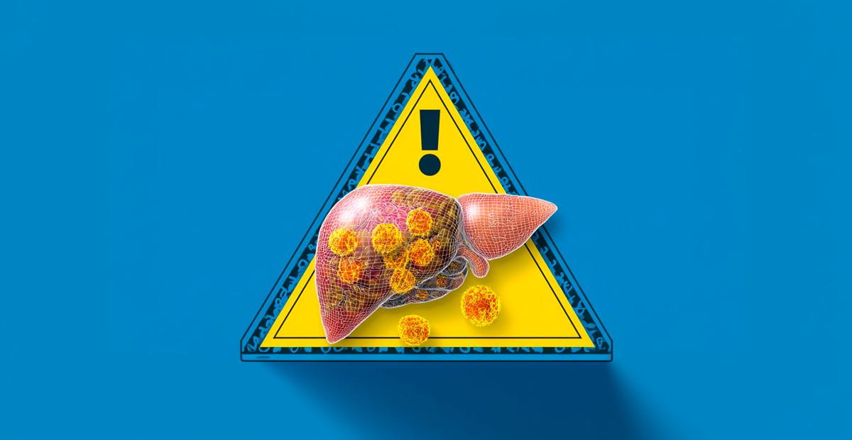 Hígado graso: las harinas refinadas impulsan esta enfermedad silenciosa